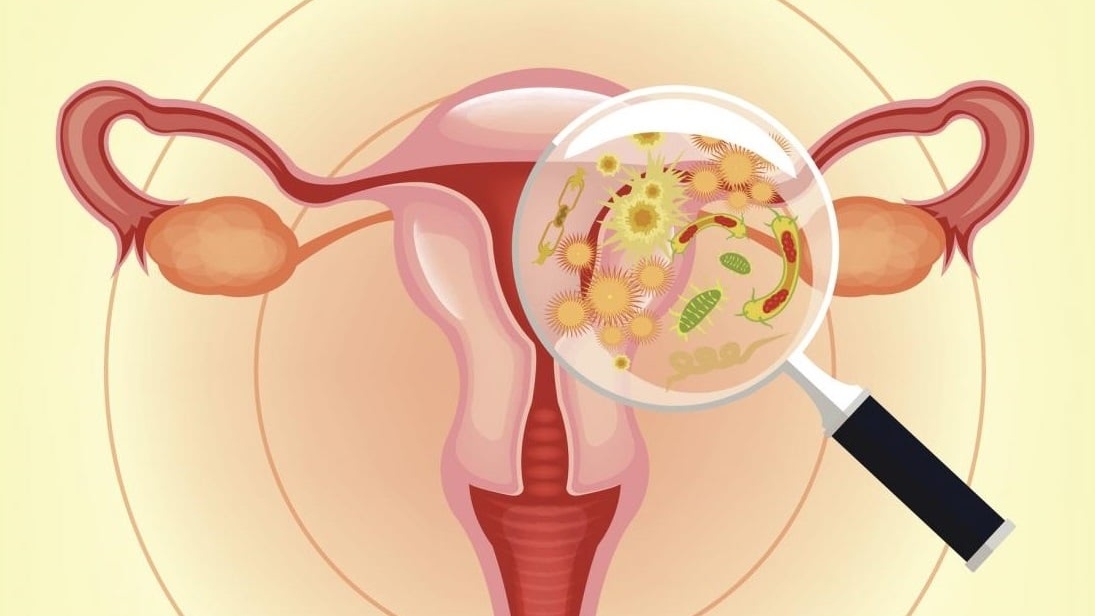 Τραχηλίτιδα