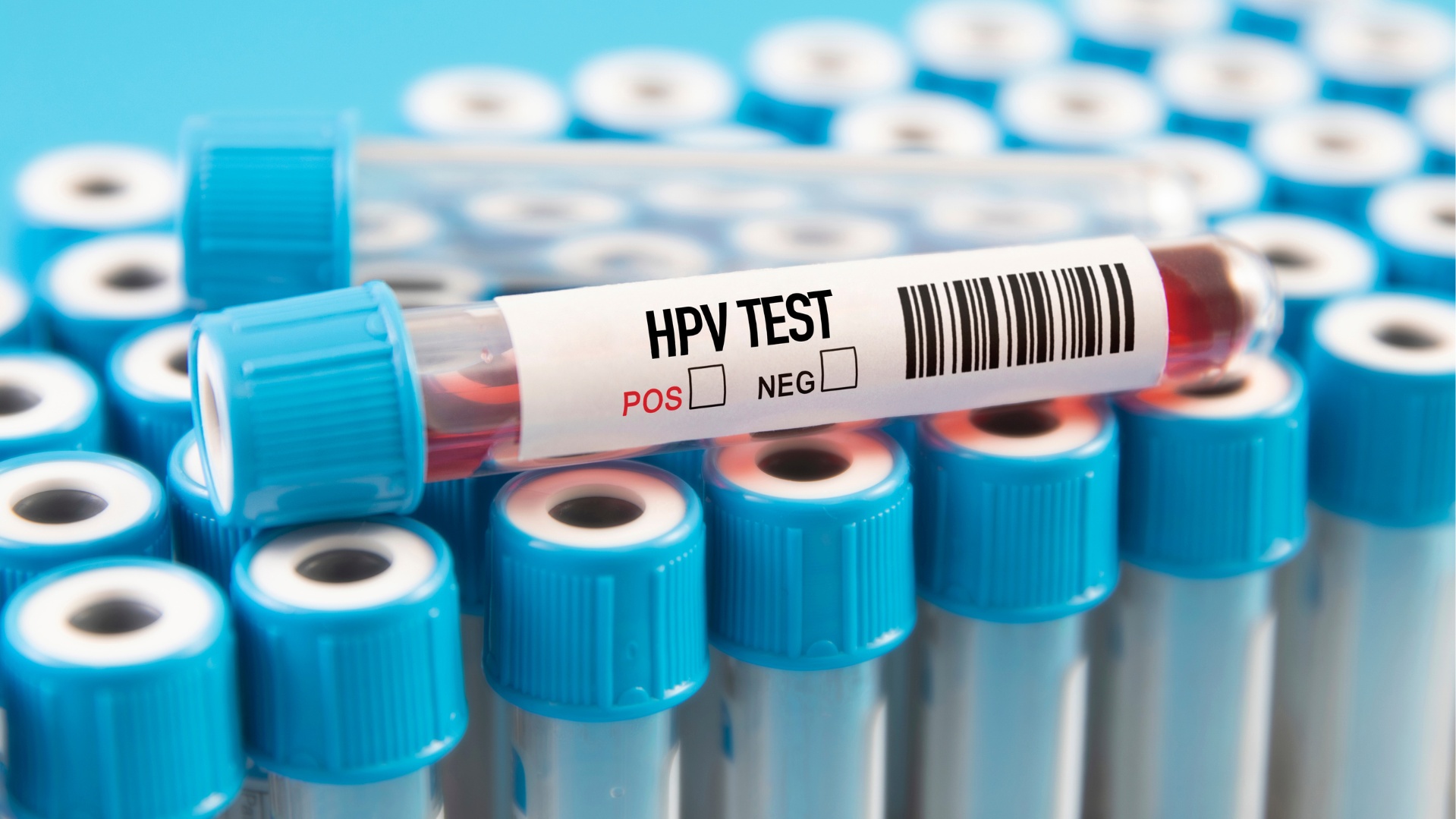 HPV τεστ